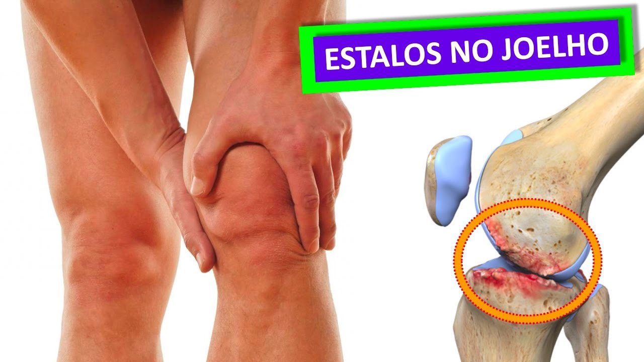 Joelho estalando: é normal?